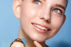 Retouch-4